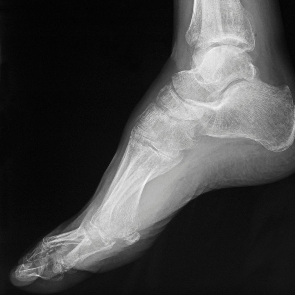 Diabetic Foot Care Fit Feet Podiatry